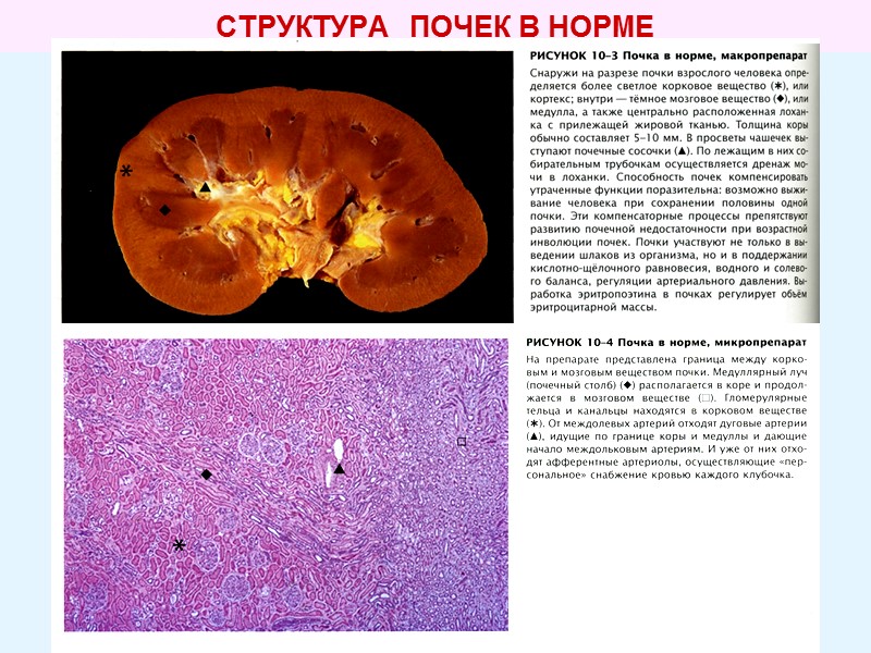 СТРУКТУРА   ПОЧЕК В НОРМЕ